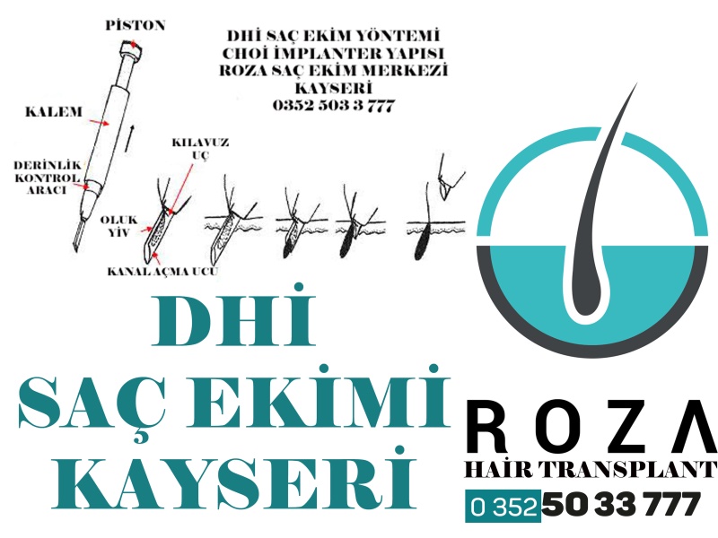 DHİ Saç Ekimi Kayseri